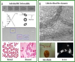Hematological Disorder and blood flow dynamics